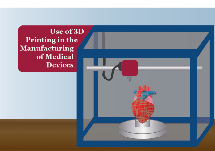 The Role Of 3d Printing In Medical Device Manufacturing