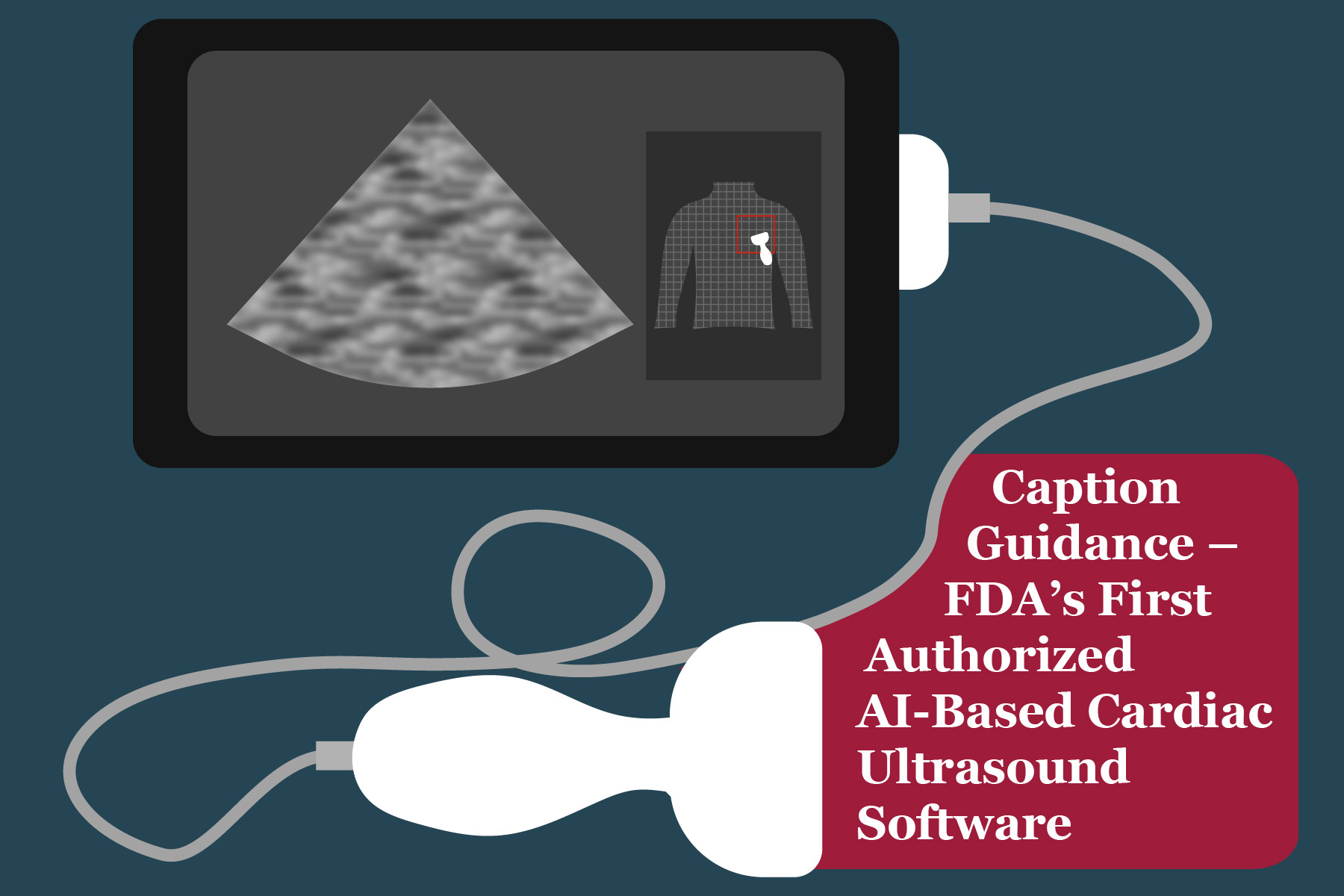 Caption Guidance – FDA’s First Authorized AI-Based Cardiac Ultrasound Software