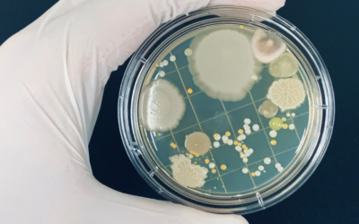 Antimicrobial Resistance: An Overview