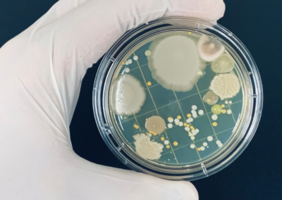 Antimicrobial Resistance: An Overview