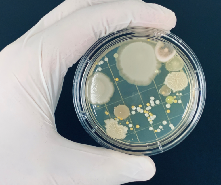 Antimicrobial Resistance: An Overview