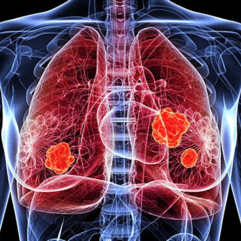 Advances in Oncology