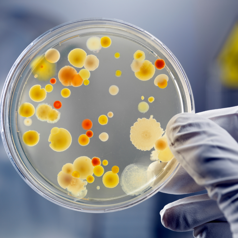 Antimicrobial Resistance: An Overview      